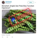 Ini Sebabnya Beberapa Ibu Susah Menahan Pipis Setelah Melahirkan