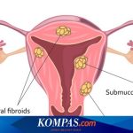 Kisah Susi Susanti Bikin Heboh Saat Hamil Anak Pertama, Suami Kena Marah